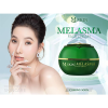 Kem-nám-Melasma-MQ-Skin---Melasma-Face-Cream-MQSkin6